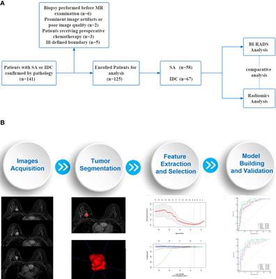 Radiomics Based on DCE-MRI Improved Diagnostic Performance Compared to BI-RADS Analysis in Identifying Sclerosing Adenosis of the Breast